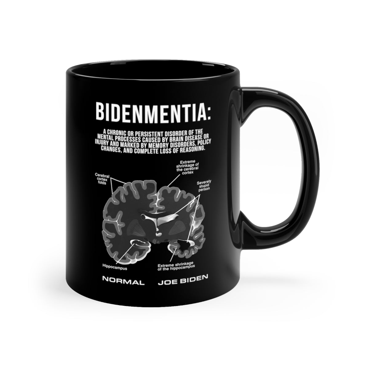 Bidenmentia Mug