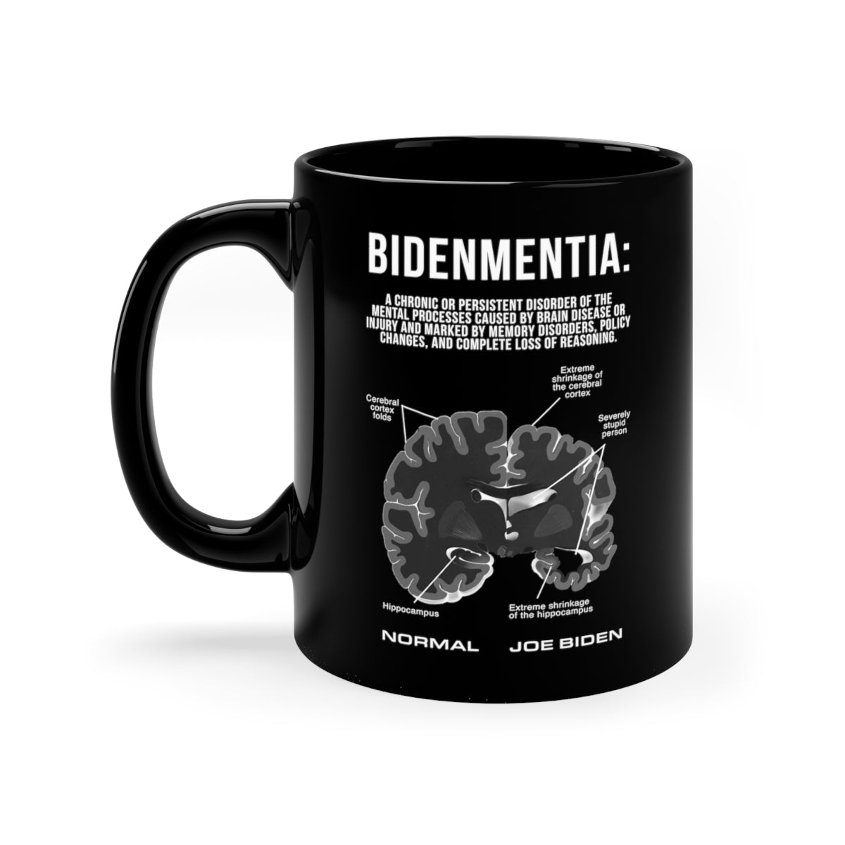 Bidenmentia Mug